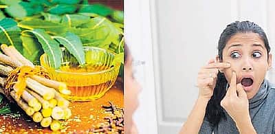 முகப்பரு பிரச்னையா? கண்ட கண்ட கிரீம்களை போடாதீங்க!