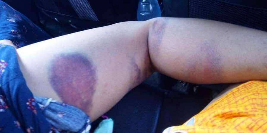 அஸாம் கொடூரம்! காவல்துறையின் அரக்கத்தனமான விசாரணையில் கருவை இழந்த கர்ப்பிணி முஸ்லிம் பெண் மற்றும் சகோதரிகள்!