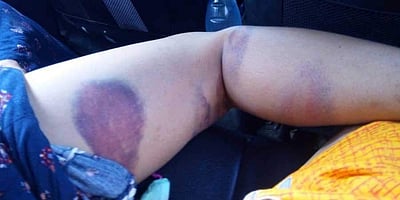 அஸாம் கொடூரம்! காவல்துறையின் அரக்கத்தனமான விசாரணையில் கருவை இழந்த கர்ப்பிணி முஸ்லிம் பெண் மற்றும் சகோதரிகள்!