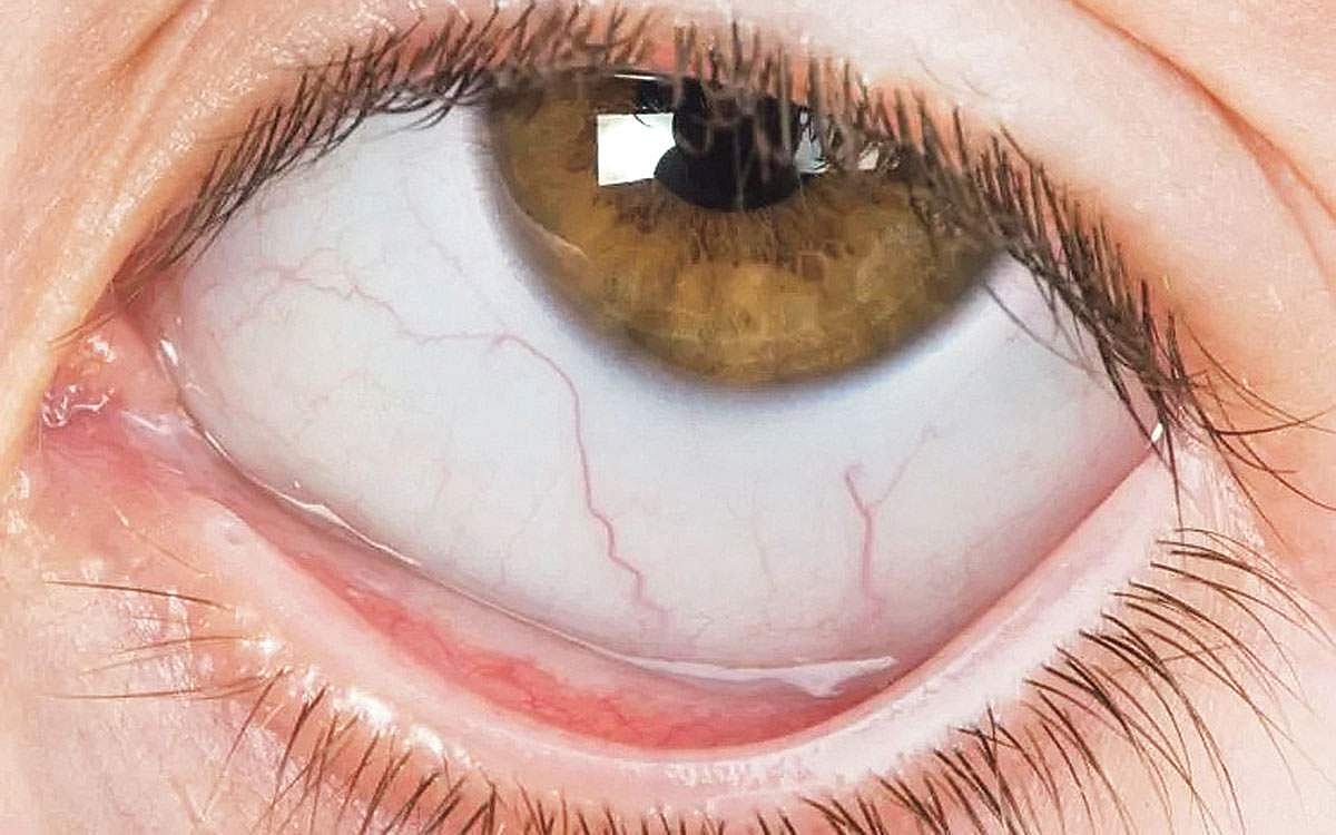 ஆயுள் காக்கும் ஆயுர்வேதம்: சிவப்பு அணுக்கள் குறைந்தால்...!