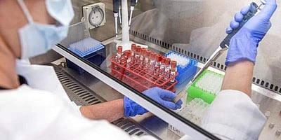 ரஷியாவில் உச்சத்தைத் தொட்ட ஒருநாள் கரோனா பாதிப்பு; 17,340 பேருக்குத் தொற்று