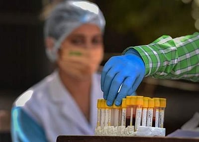 சென்னையில் 723 பேருக்கு கரோனா : மாவட்டவாரியாக