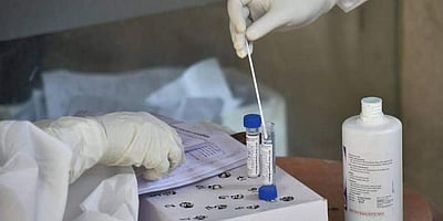 ரஷியாவில் புதிய உச்சம்: ஒரேநாளில் 22,778 பேருக்கு கரோனா