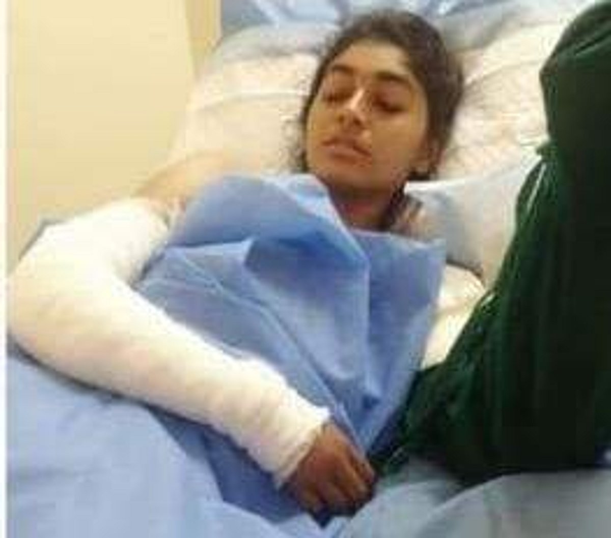 மின் கம்பி அறுந்து விழுந்ததில் கல்லூரி மாணவி கை வெட்டி அகற்றம்: பெற்றோர் வேதனை