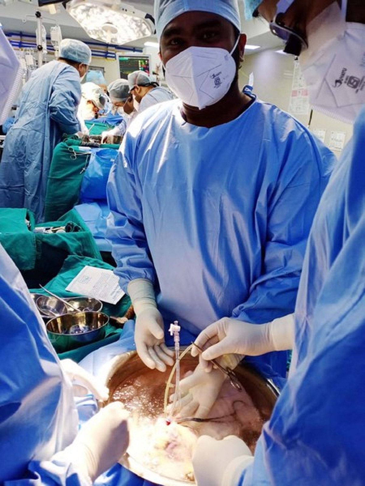 எய்ம்ஸில் 20 வயது இளைஞருக்கு இதய மாற்று அறுவைச் சிகிச்சை