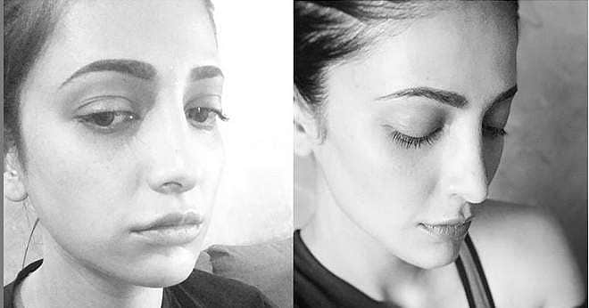 பிளாஸ்டிக் சர்ஜரி செய்துகொண்டது பற்றி மனம் திறந்த நடிகை ஸ்ருதி ஹாசன்!