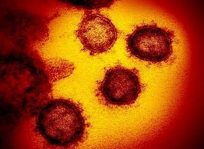 லக்னௌவில் மேலும் 4 பேருக்கு கரோனா தொற்று