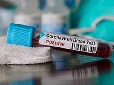 புதுச்சேரியில் இருவருக்கு கரோனா தொற்று: சீல் வைக்கப்பட்ட 2 பகுதிகள்