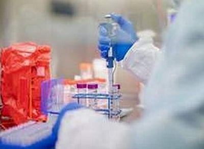 ஸ்பெயினில் 24 மணி நேரத்தில் 440 பேர் பலி