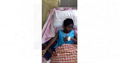 மானாமதுரை அருகே குரங்கு கடித்து சிறுமி காயம்