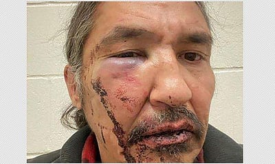 கனடாவில் பூர்விகக் குடியினத் தலைவர் தாக்கப்பட்ட அதிர்ச்சி விடியோ வெளியானது!