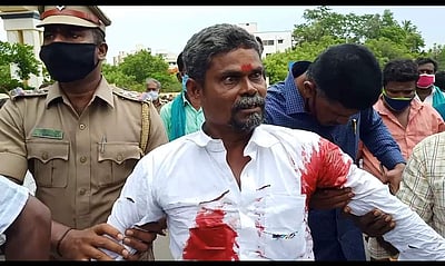 போராட்டத்தில் கத்தியால் குத்திக்கொண்ட விவசாயி!