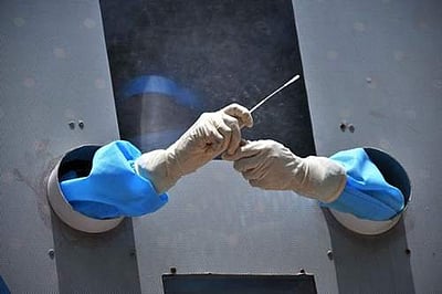 உலகம் முழுவதும் பாதிப்பு 2.33 கோடி: பலி 8.08 லட்சத்தைத் தாண்டியது