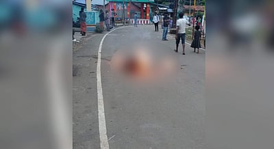 கொடைக்கானலில் இளம்பெண் தீக்குளித்து தற்கொலை