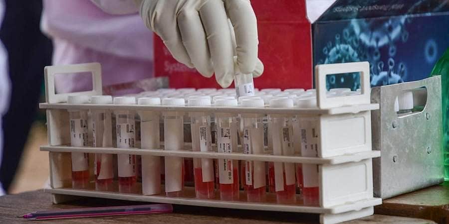 பரிசோதனையே செய்து கொள்ளாத 15 பேருக்கு கரோனா உறுதி செய்யப்பட்டது எப்படி?