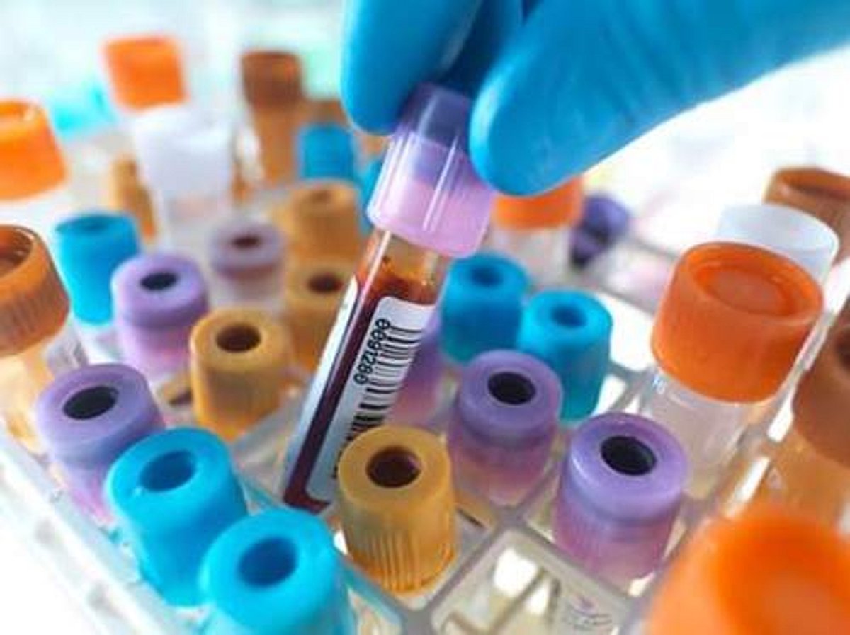 தாணே மாவட்டத்தில் மேலும் 1,749 பேருக்குத் தொற்று: 35 பேர் பலி