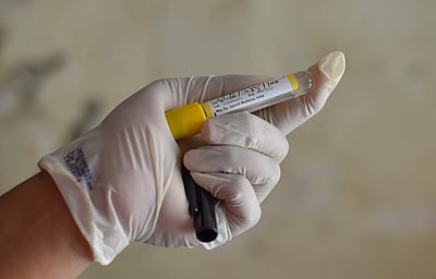 சென்னையில் குணமடைந்தோர் விகிதம் 89% ஆக உயர்வு