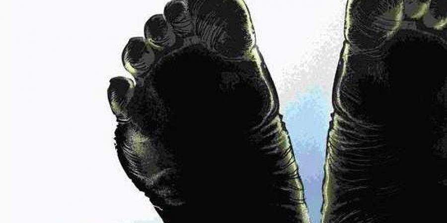 பீடி வாங்கிவர தாமதம்: தந்தையால் தீ வைக்கப்பட்ட சிறுவன் பலி