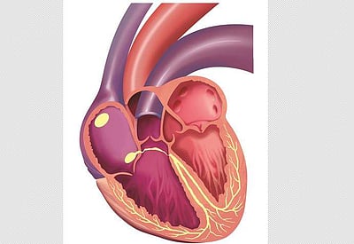 மனிதருக்கு பன்றியின் இதயத்தைப் பொருத்தி அமெரிக்க மருத்துவர்கள் சாதனை