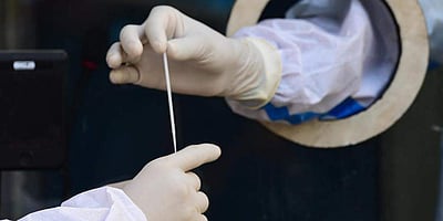 கர்நாடகத்தில் இன்று மேலும் 550 பேருக்கு கரோனா