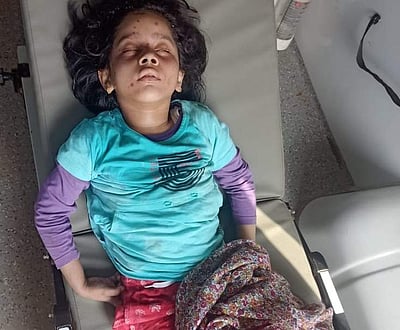 அவிநாசி: மயக்க நிலையில் சிகிச்சை பெற்று வந்த சிறுமி உயிரிழப்பு