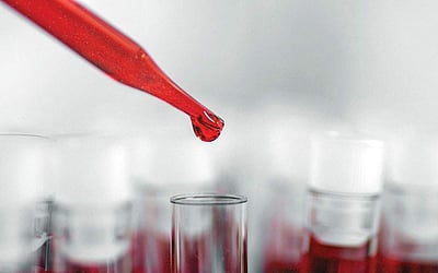 ரத்தத்தின் ரத்தமே... - 42 