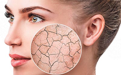 சருமம் வறண்டு பொலிவிழந்து காணப்படுகிறதா? 