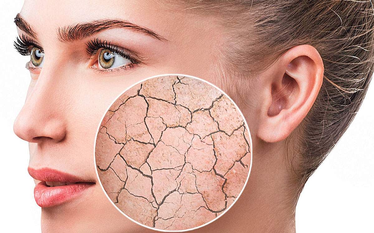 சருமம் வறண்டு பொலிவிழந்து காணப்படுகிறதா?