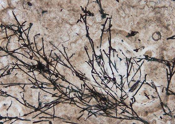 அறிவியல் ஆயிரம்: உலகின் முதல் உயிரி பூஞ்சை கண்டுபிடிப்பு