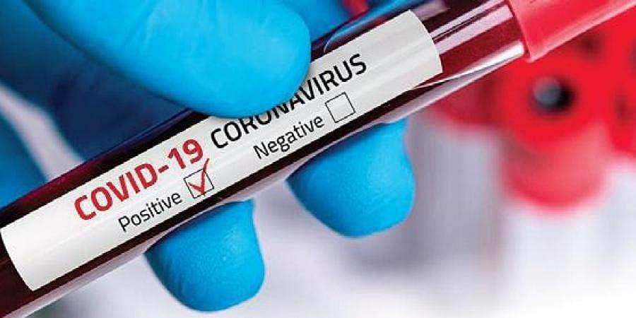 இந்தியாவில் புதிதாக 24,492 பேருக்கு கரோனா; 131 பேர் பலி