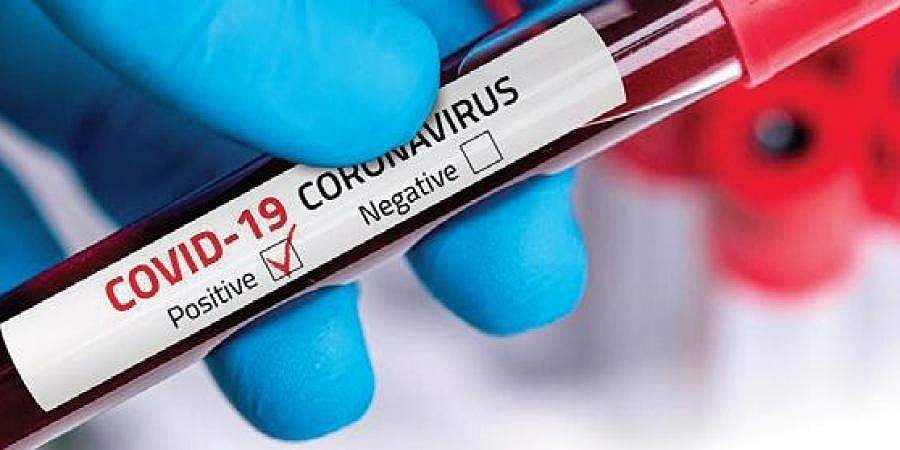 இந்தியாவில் புதிதாக 24,492 பேருக்கு கரோனா; 131 பேர் பலி