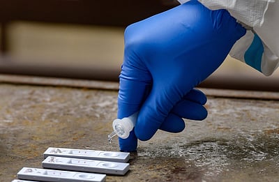 புதுச்சேரியில் 10 பேருக்கு இன்புளுயன்சா காய்ச்சல்: சுகாதாரத்துறை