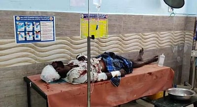 பெரியகுளம் அருகே கோஷ்டி மோதல்: இருவருக்கு அரிவாள் வெட்டு