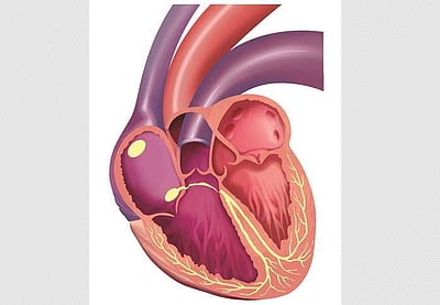 இருதய மாற்று அறுவைச் சிகிச்சை: கொச்சியிலிருந்து 1 மணி நேரத்தில் சென்னை வந்த இதயம்