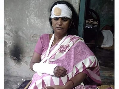 சீர்காழி அருகே தொகுப்பு வீட்டின் மேற்கூரை பெயர்ந்து விழுந்து பெண் காயம்