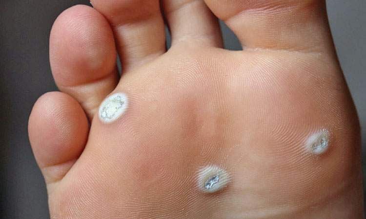 ஆயுள் காக்கும் ஆயுர்வேதம்: நுண்ணிய நரம்பு அமைப்புள்ள பாதங்கள்!