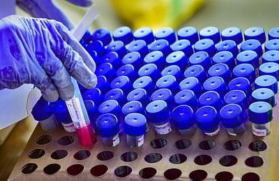 முன்களப் பணியாளர்கள் ஒரு வாரத்துக்குள் கரோனா தடுப்பூசி போட்டுக்கொள்ள தெலங்கானா முதல்வர் அறிவுறுத்தல்