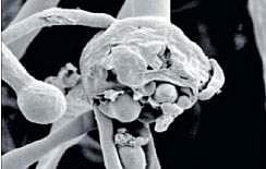 உ.பி.யில் ஒருவருக்கு வெள்ளை பூஞ்சை நோய் பாதிப்பு