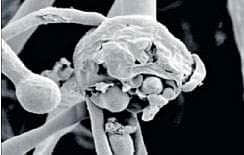 உ.பி.யில் ஒருவருக்கு வெள்ளை பூஞ்சை நோய் பாதிப்பு 