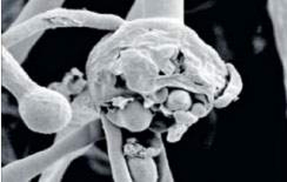 உ.பி.யில் ஒருவருக்கு வெள்ளை பூஞ்சை நோய் பாதிப்பு