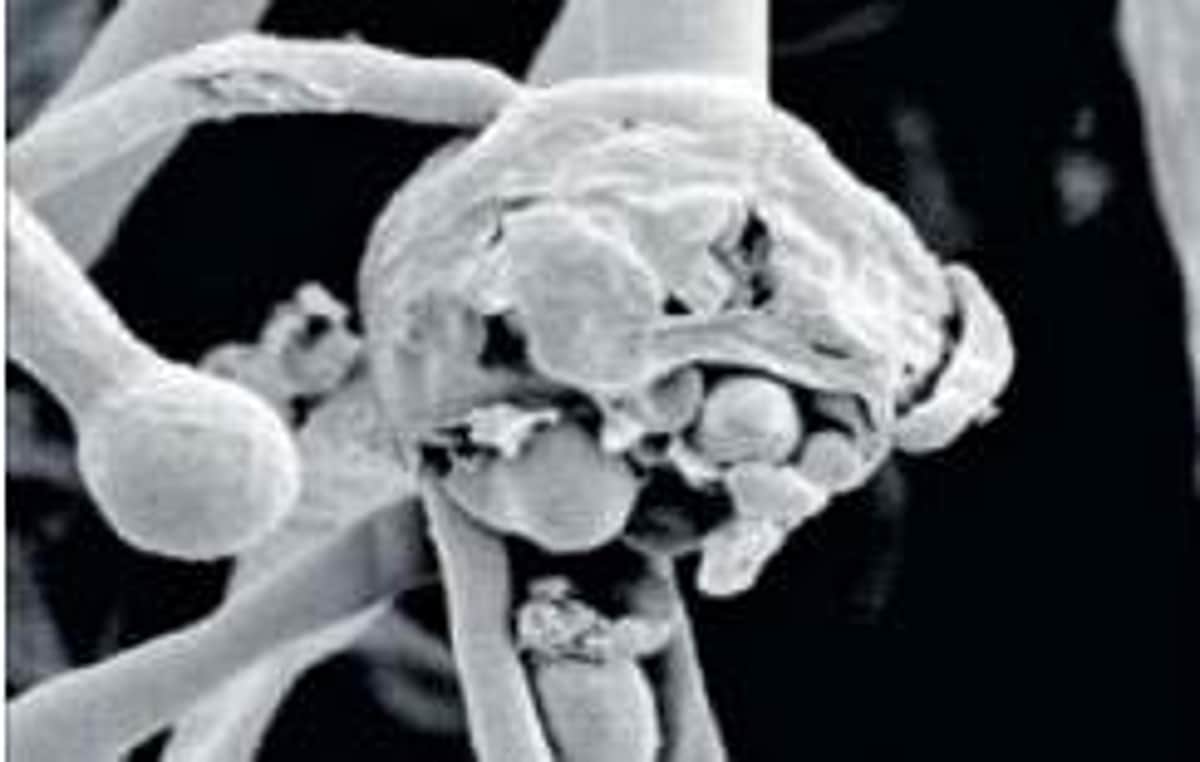 வங்க தேசத்தில் கருப்பு பூஞ்சைக்கு முதல் நபர் பாதிப்பு