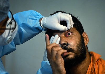 கர்நாடகத்தில் 1,370 பேருக்கு கருப்புப் பூஞ்சை பாதிப்பு