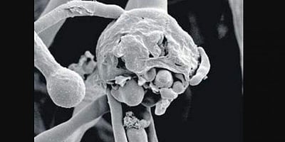 மகாராஷ்டிரத்தில் கருப்புப் பூஞ்சைக்கு 729 பேர் பலி