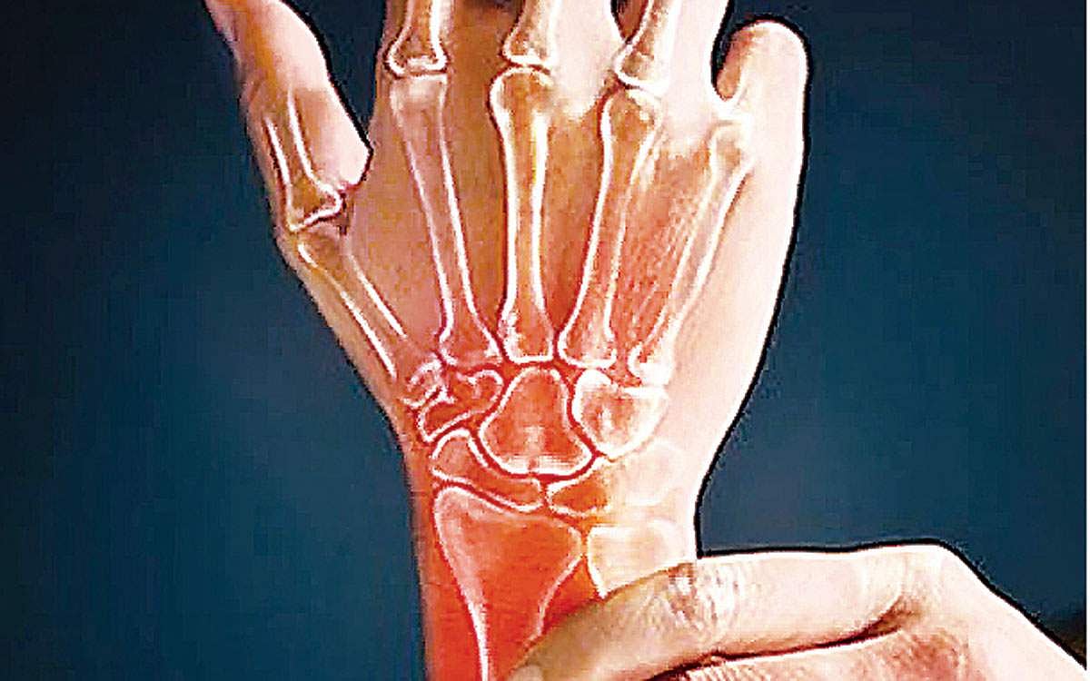 ஆயுள் காக்கும் ஆயுர்வேதம்: ரத்த வாதம் குணமாக...!