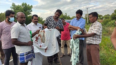 துறையூர் அருகே சிறுத்தை தாக்கியதாக மருத்துவமனையில் 2 பேருக்கு சிகிச்சை