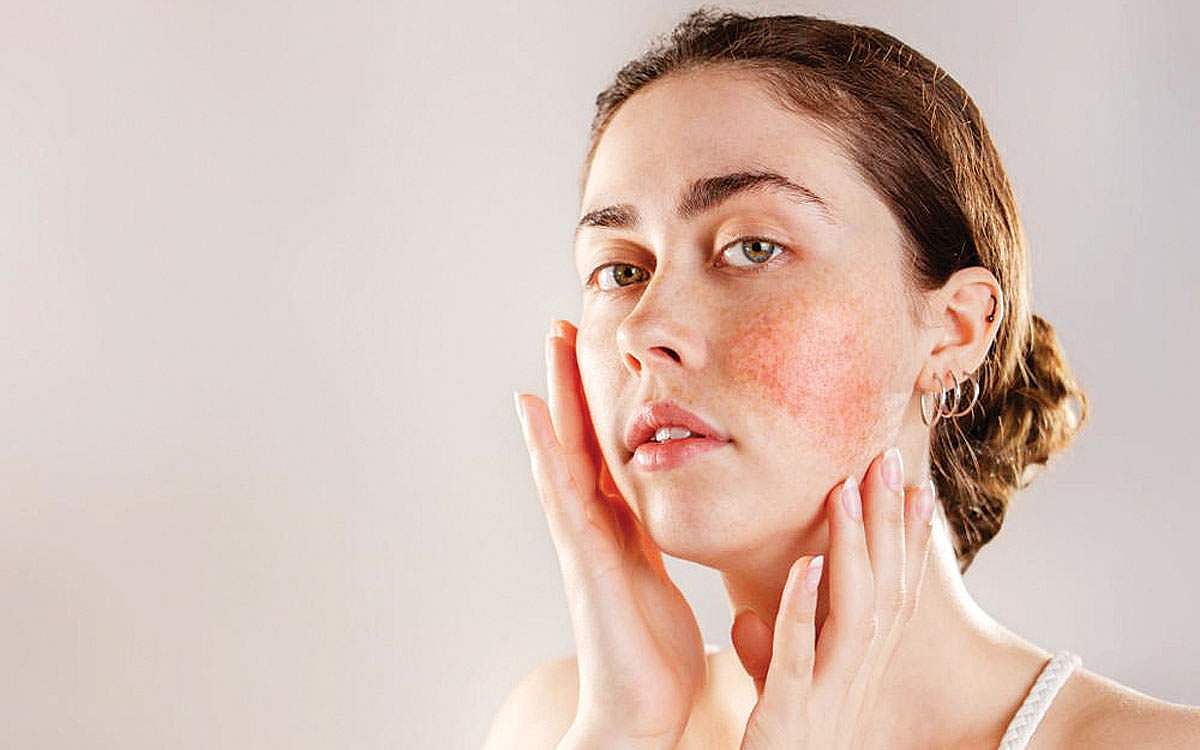 சருமத்தில் ஏற்படும் தடிப்பு நீங்க!