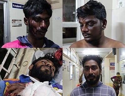 நாகை மீனவர்கள் 4 பேர் மீது தாக்குதல்: இலங்கை மர்ம நபர்கள் அட்டூழியம்