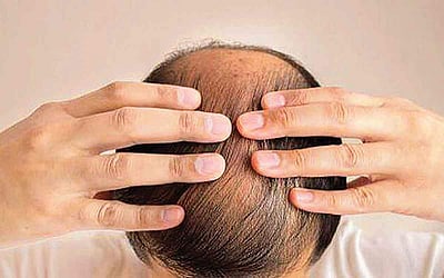 ஆயுள் காக்கும் ஆயுர்வேதம்: தலையில் அரிப்பு, எரிச்சல் குறைய...!