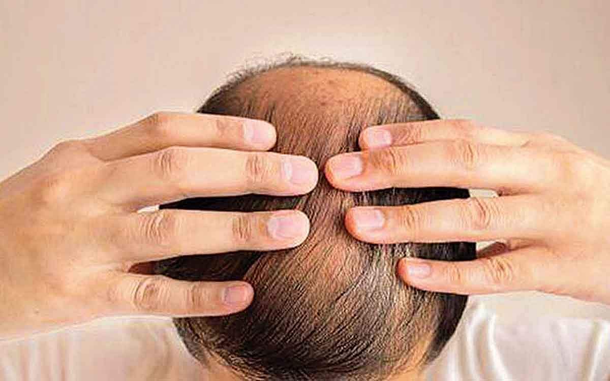 ஆயுள் காக்கும் ஆயுர்வேதம்: தலையில் அரிப்பு, எரிச்சல் குறைய...!