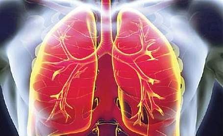 கரோனாவுக்குப் பிறகு காசநோயாளிகள் அதிகரிப்பு: நிபுணர்கள்